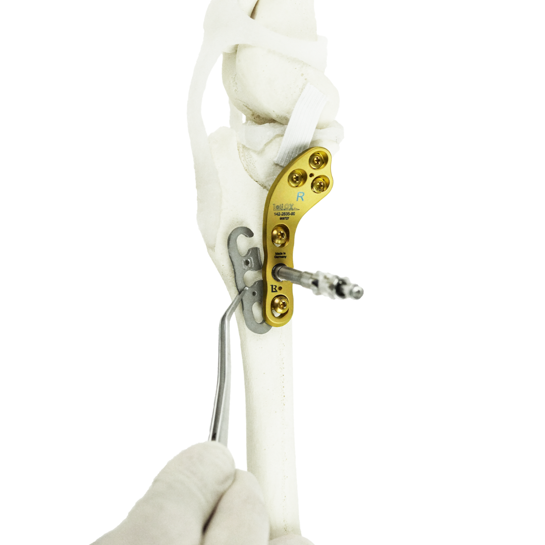 Comprehensive TPLO Course