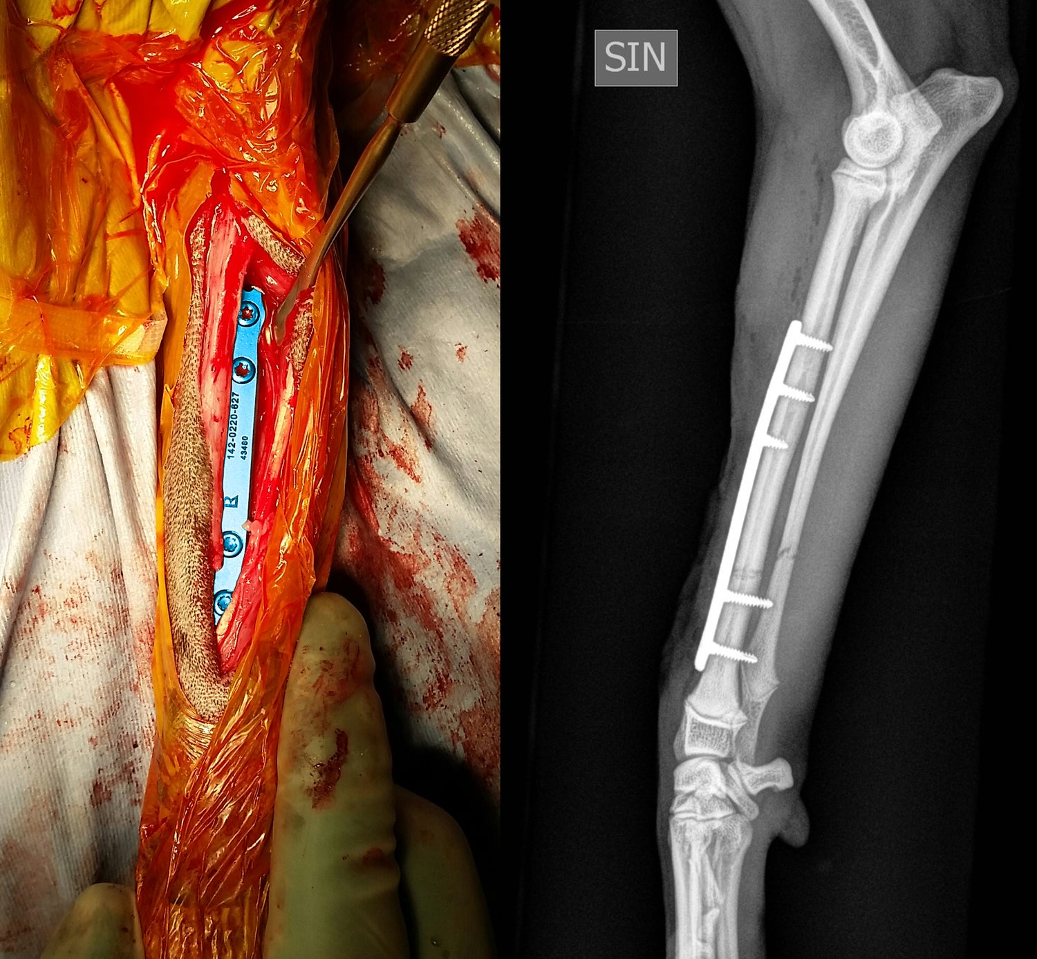 2- Day Fracture Course