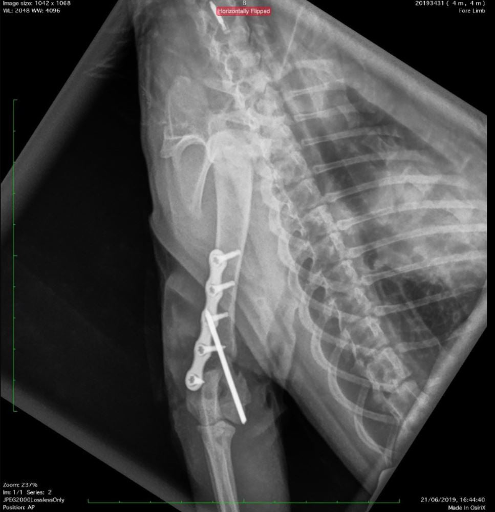 2- Day Fracture Course