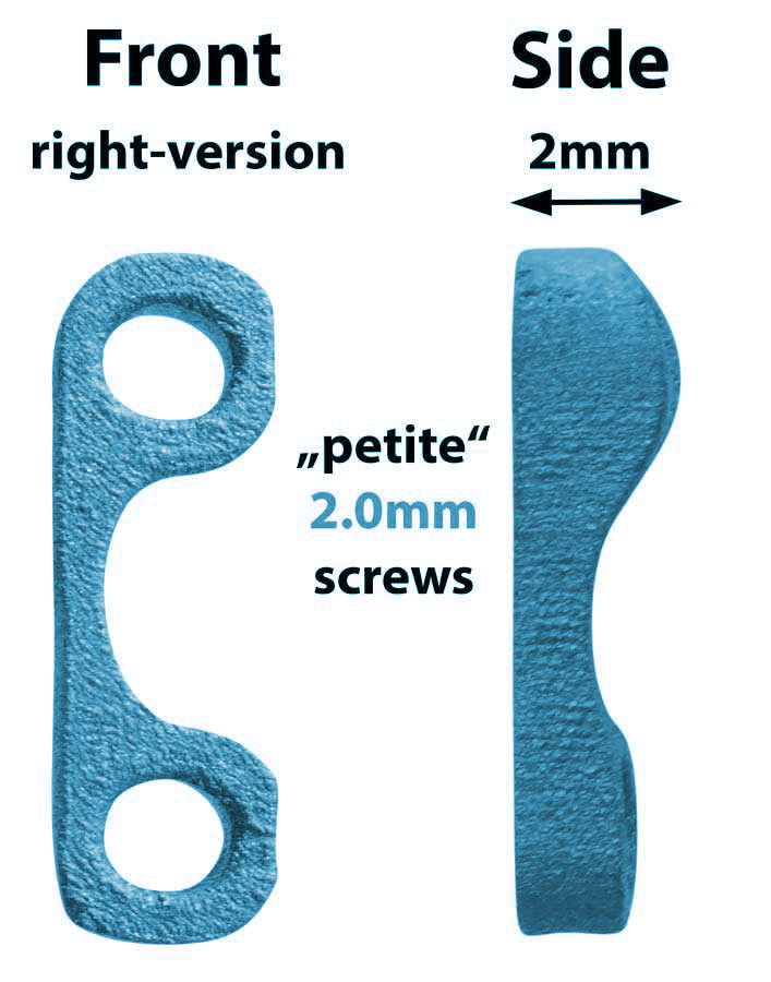 2.0mm "Petite" Patella Spacers