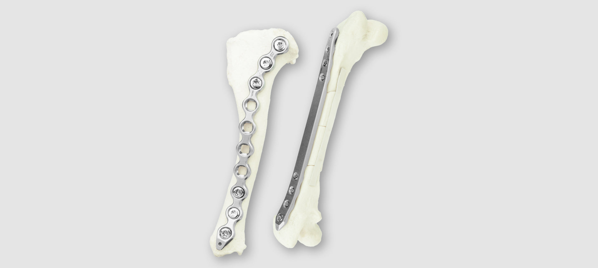 LeiLOX Locking 2.0 - 3.5 Stainless Steel