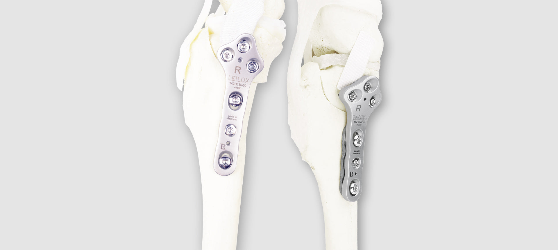 TPLO Stainless Steel