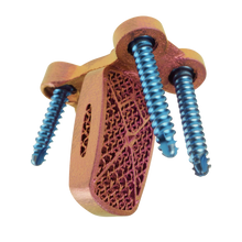 C-LOX Spinal Cage