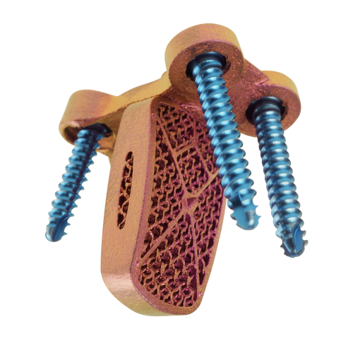 C-LOX Spinal Cage