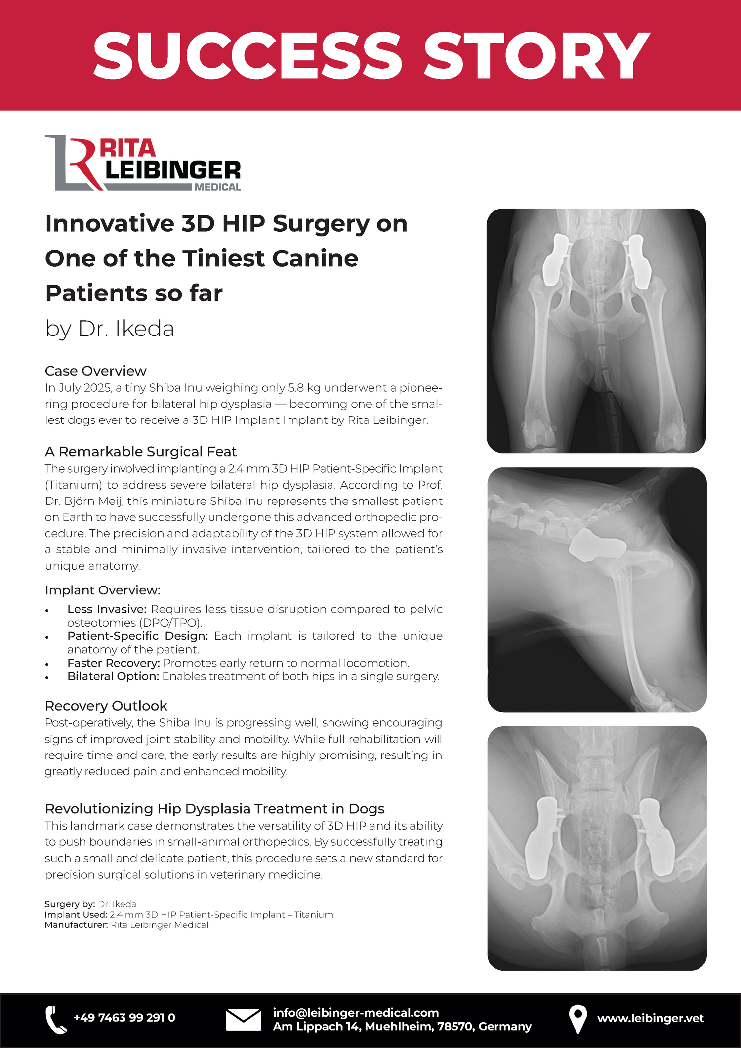 3D Hip Course: Shelf Arthroplasty of Dorsal Acetabular Rim