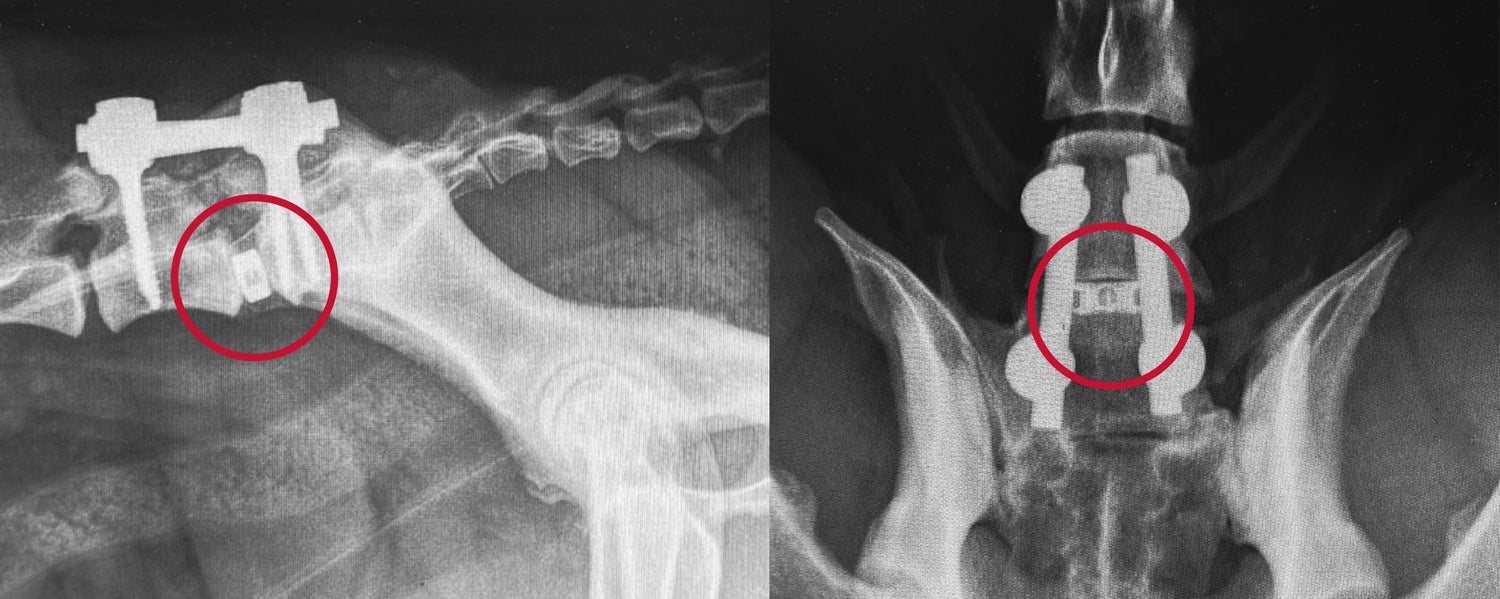 Spinal Course: Pedicle Screw and Intervertebral Cage Systems