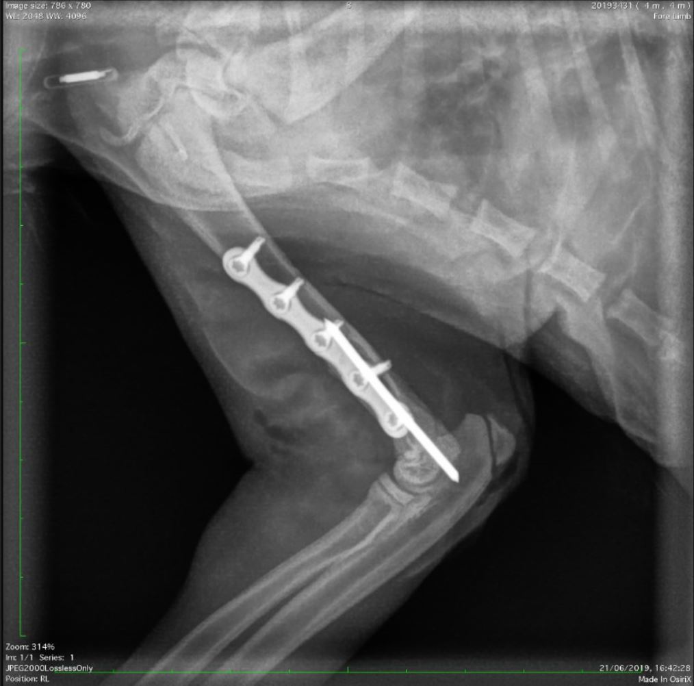 2- Day Fracture Course