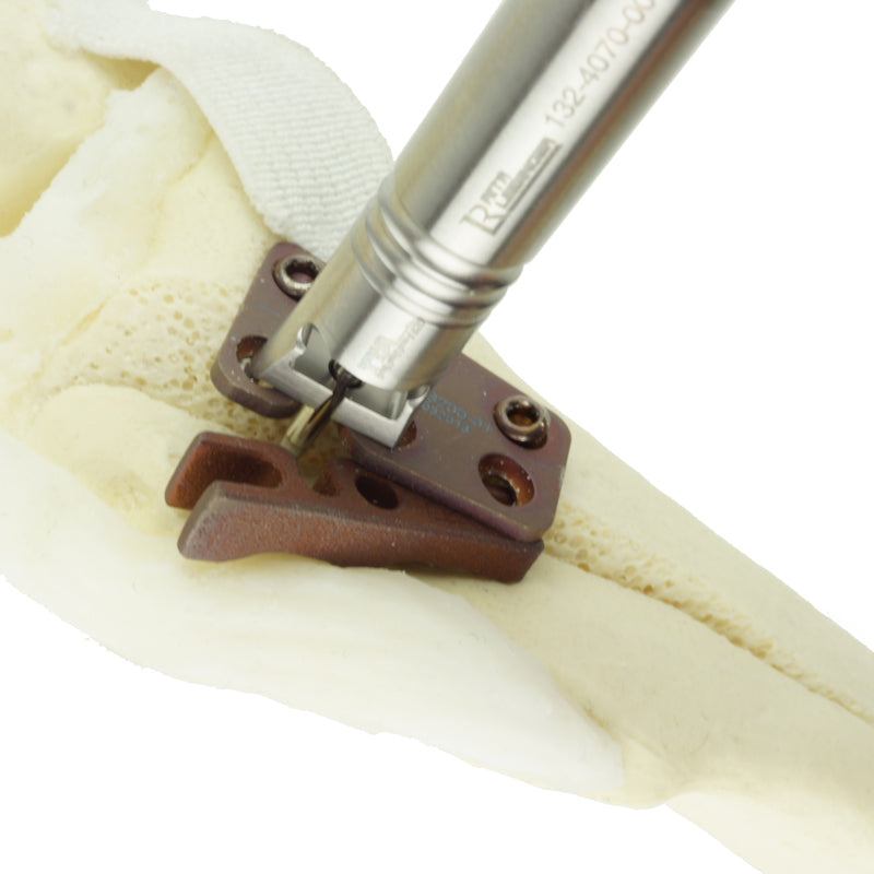 Tibia Tappet