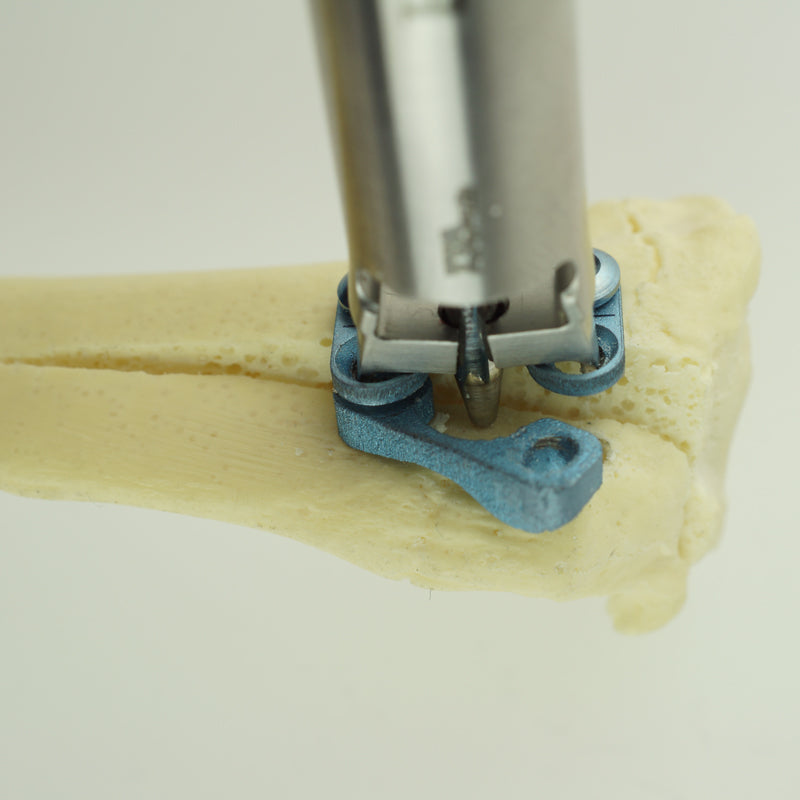 Tibia Tappet